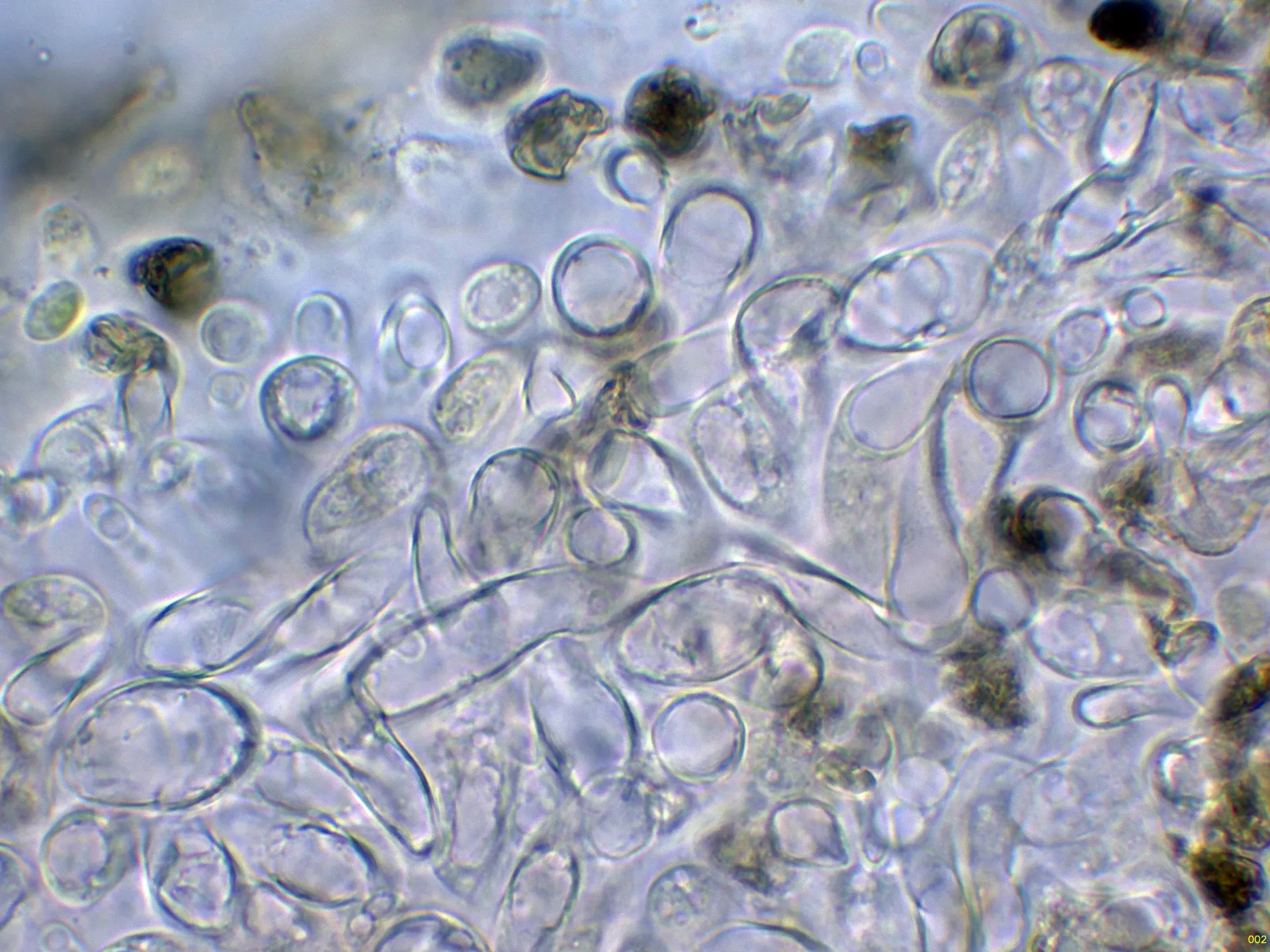 Microscopía de Suillellus luridus - 10 - Suprapellis agua-002